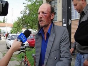 un bărbat din miercurea sibiului a atacat un poliţist cu briceagul la arad