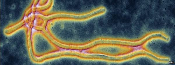 _77334515_c0215902-coloured_tem_of_the_ebola_virus-spl