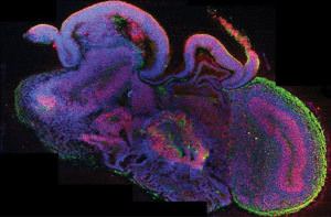 cercetatorii austriecice au obținut un creier uman in miniatura