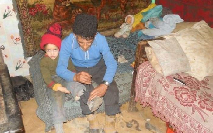 update - bătrânelul din județul sibiu care și-a crescut singur nepoatele a rămas fără picioare din cauza unei boli. fetele au ajuns la tatăl lor