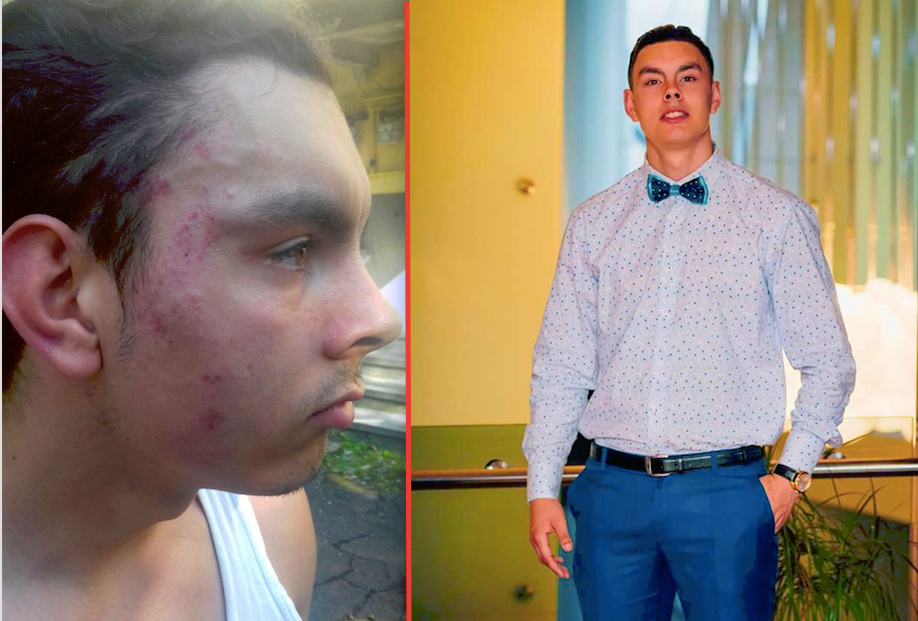 foto – tânăr bătut de un taximetrist la sibiu. spune că a fost agresat fără motiv