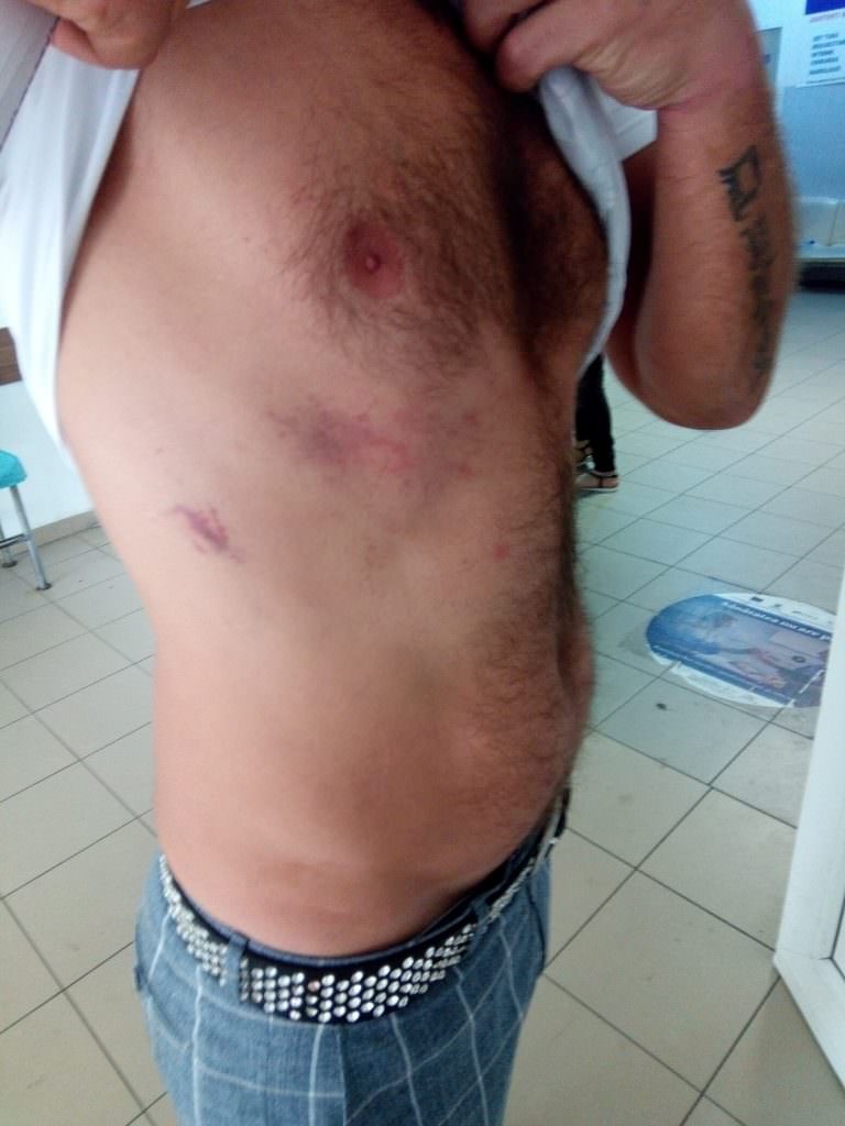 video foto - polițiști acuzați că au bătut un om la miercurea sibiului. oamenii legii spun altceva