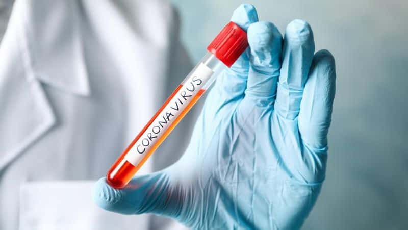 update coronavirus - experţii cer să fie testaţi cetăţenii; în românia vor fi testaţi doar cei cu simptome
