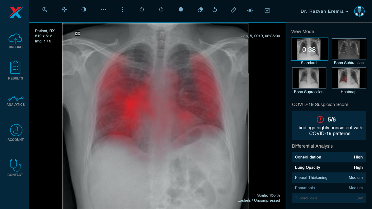 inteligența artificială în spitalele din sibiu – un soft identifică patologii de pe radiografii