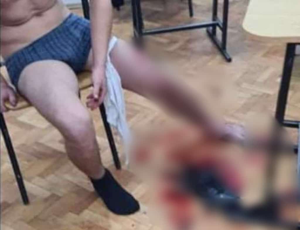 cazul băiatului înjunghiat la școală în mediaș - apar fotografii de la incident - director: „s-au jucat, nu a fost premeditat” - victima a mințit