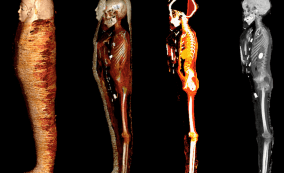 oamenii de știință au ”scanat digital” mumia ”băiatului de aur” - au fost descoperite zeci de amulete prețioase din aur