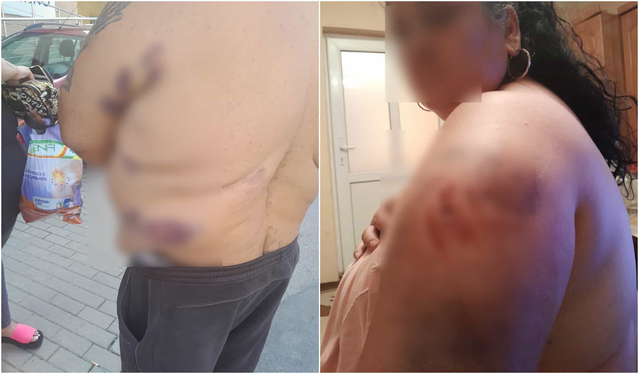 răfuială ca-n telenovele în țiglari. acuzații și bătăi între două familii: „mi-a zis că mă bagă în sicriu” (video, foto)