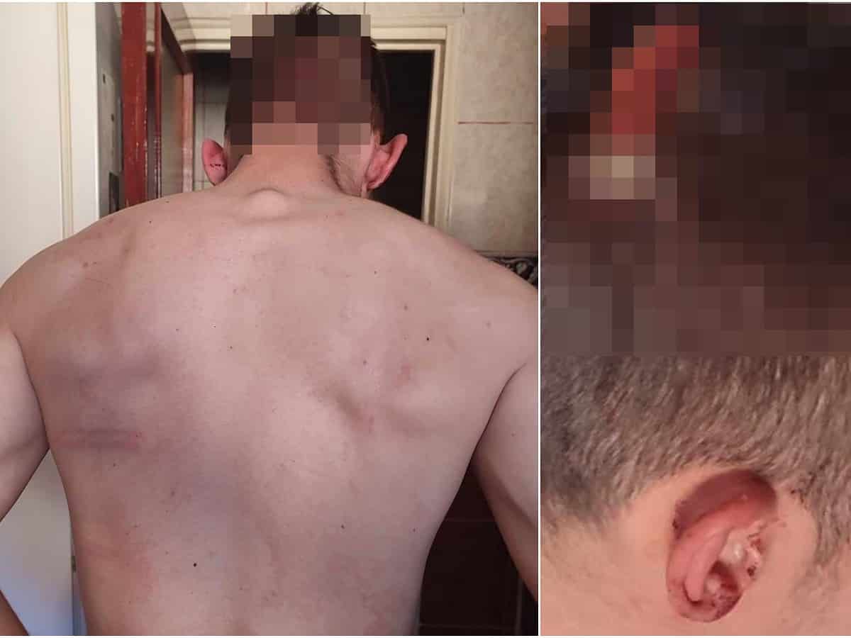 un tânăr din sibiu acuză că a fost bătut de un polițist. șeful ipj: se fac cercetări pentru ultraj (foto)