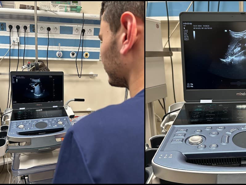 un nou ecograf performant, donat la spitalul clinic județean de urgență din sibiu (foto)