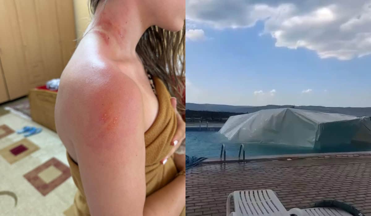 tânără la un pas de moarte după ce un cort de evenimente s-a răsturnat peste ea în timp ce se relaxa în piscina unei pensiuni din județul sibiu (video foto)